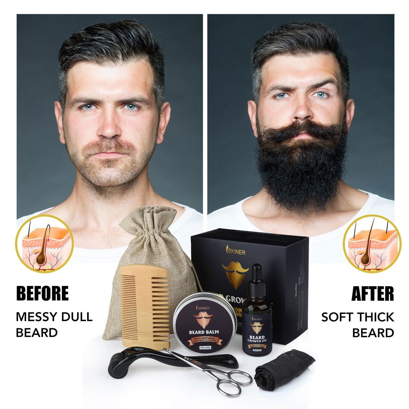 Skiner Beard Growth Kit Serum With Roller For Men - Viva Timepiece -  - 